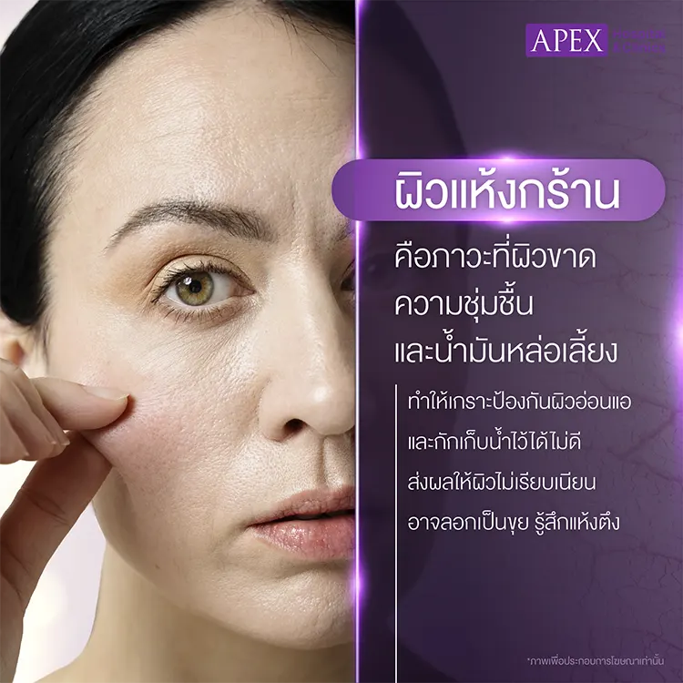 ผิวแห้งกร้าน