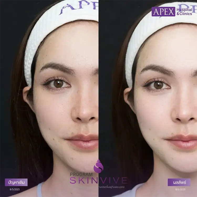 ผิวแห้งกร้าน