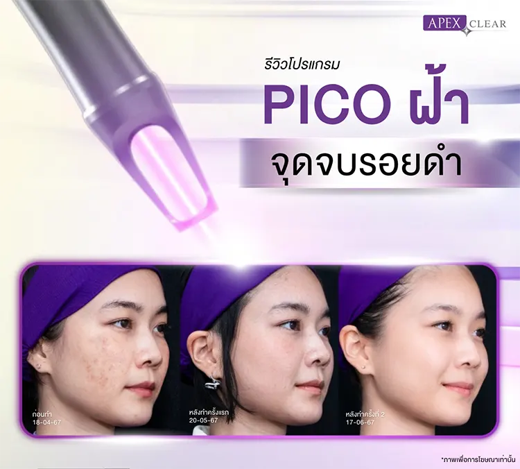 ผิวหมองคล้ำ