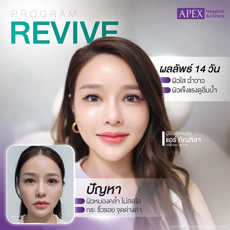 ผิวดารา