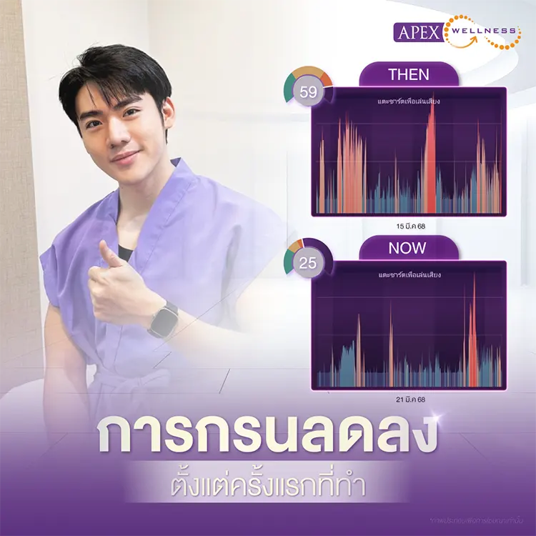 เลเซอร์นอนกรน