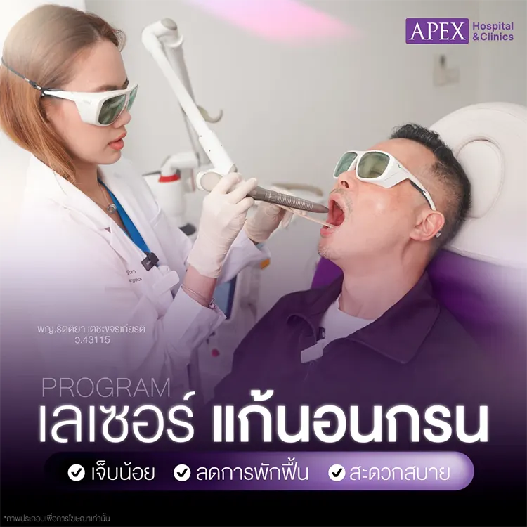 เลเซอร์นอนกรน