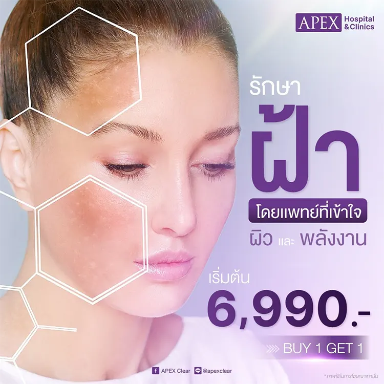 ฝ้า