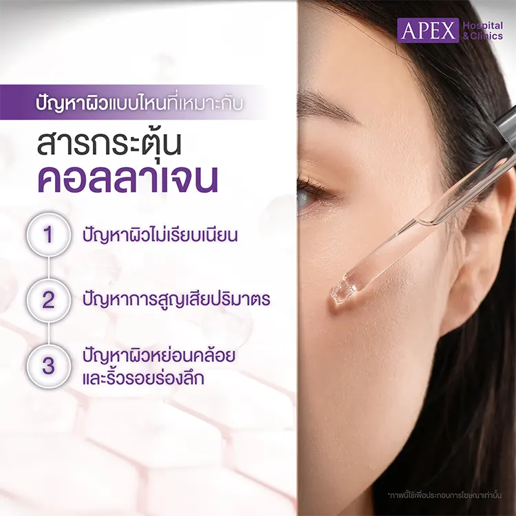 สารกระตุ้นคอลลาเจน