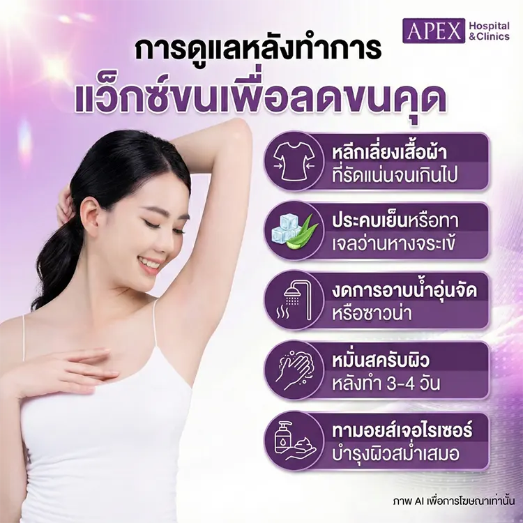 แว็กซ์ขน