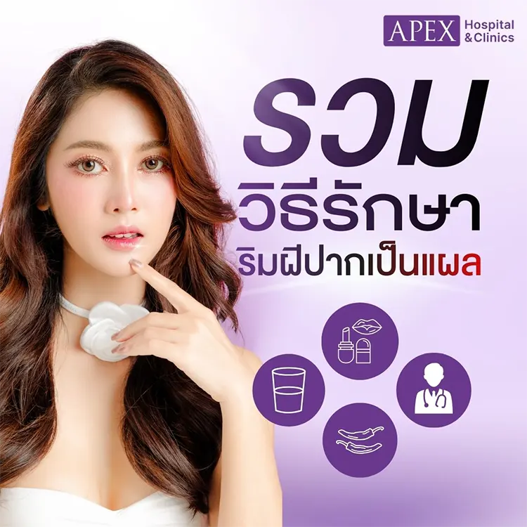 ริมฝีปากเป็นแผล