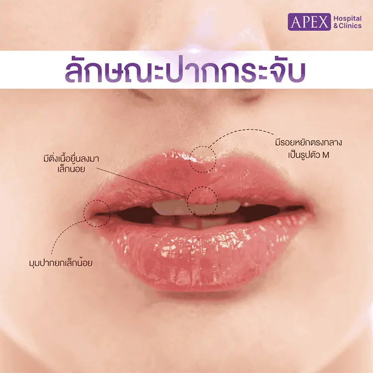 ปากกระจับ