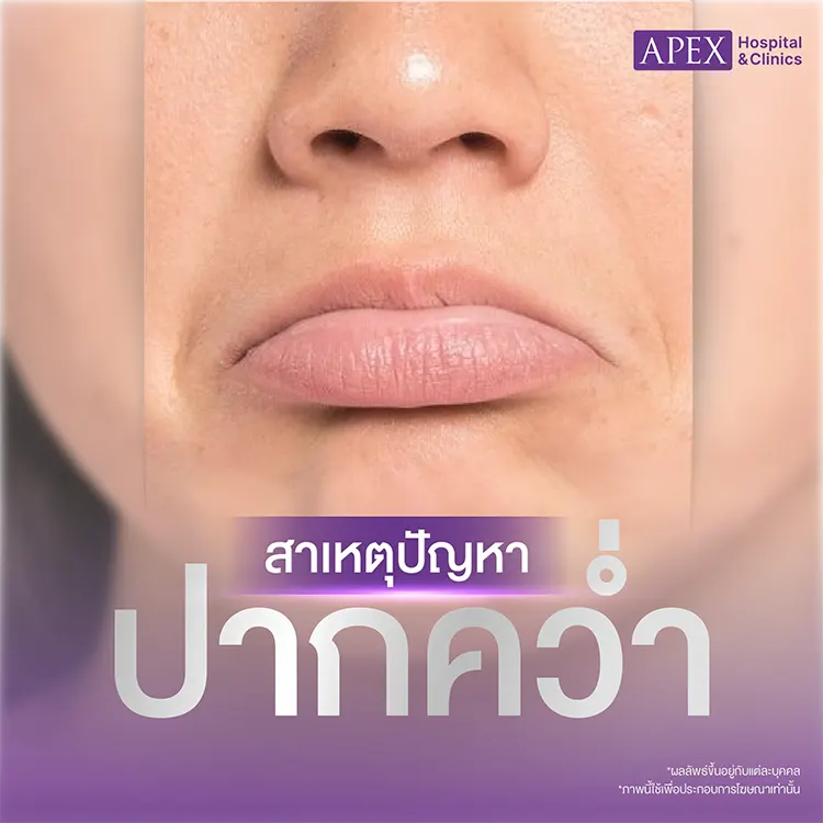 ปากคว่ำ