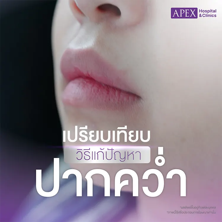 ปากคว่ำ