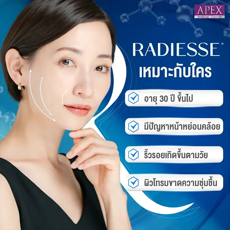 Radiesse เหมาะกับใคร กรอบหน้าชัดลดริ้วรอย