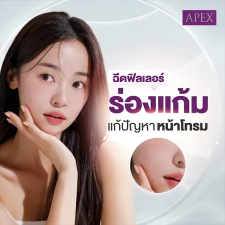 ฉีดฟิลเลอร์ร่องแก้ม คืออะไร แก้ปัญหาหน้าโทรมได้อย่างไร