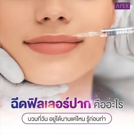 ฉีดฟิลเลอร์ปาก คืออะไร บวมกี่วัน ฉีดปากอยู่ได้นานแค่ไหน