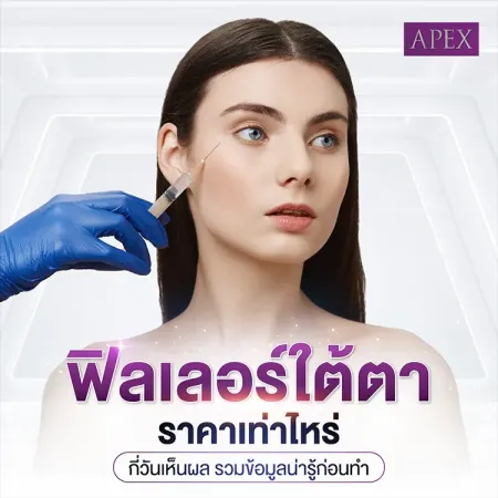 ฉีดฟิลเลอร์ใต้ตา คืออะไร มีข้อดีข้อเสียอย่างไร กี่วันเห็นผล