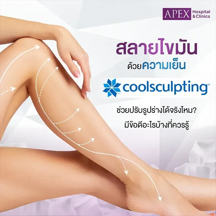 Coolsculpting ช่วยลดไขมัน ลดน้ำหนัก ปรับรูปร่างสวยได้ไหม?