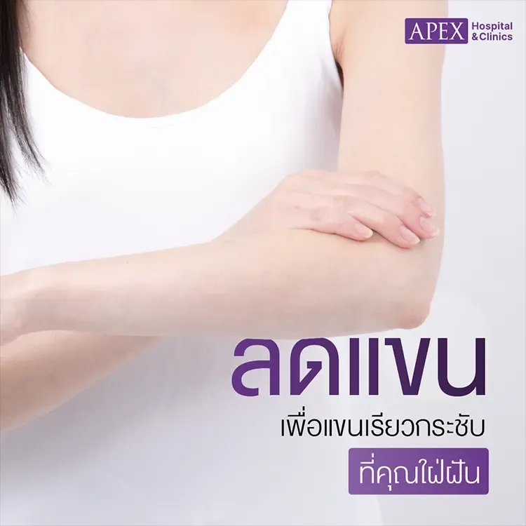 CoolSculpting ลดแขน อย่างมีประสิทธิภาพ เห็นผลไวจริงไหม