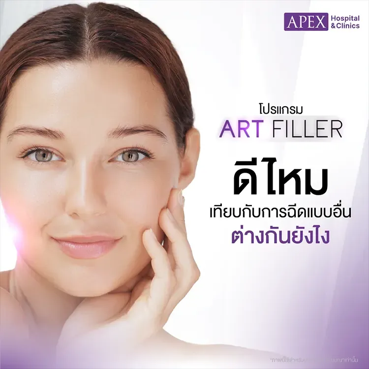 Art Filler คืออะไร แตกต่างจากฉีดฟิลเลอร์อื่นอย่างไร มีกี่รุ่น