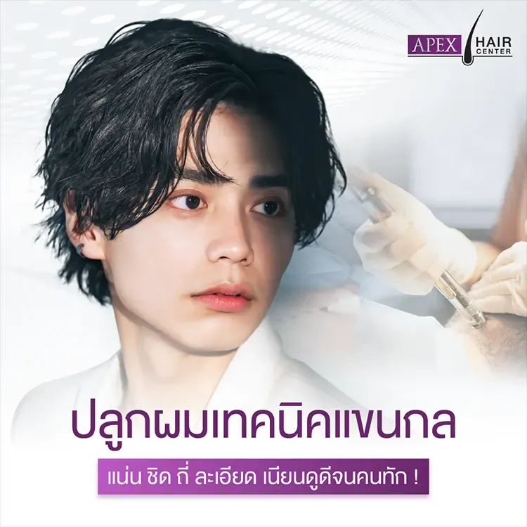 ปลูกผม Advance FUE vs FUT ต่างกันอย่างไร มีข้อดีข้อเสียอะไรบ้าง?