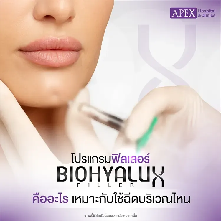 ฟิลเลอร์ Biohyalux Filler คืออะไร ต่างจากฉีดหน้าใสยี่ห้ออื่นยังไง