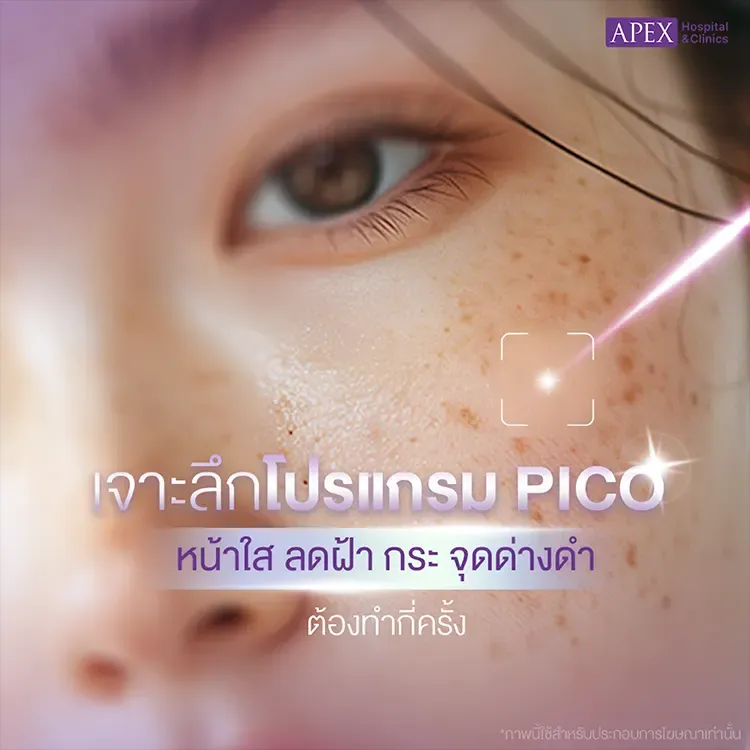 Pico หน้าใส คืออะไร ลดฝ้า กระ จุดด่างดำ ต้องทำกี่ครั้ง