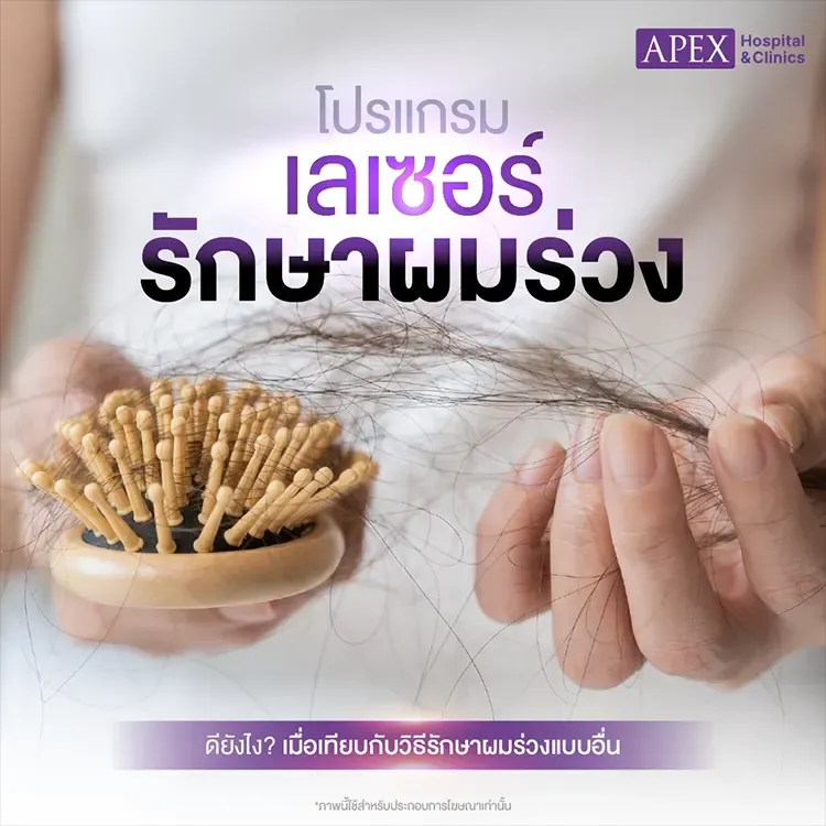 เลเซอร์รักษาผมร่วง คืออะไร เหมาะกับใคร ข้อดีข้อเสีย