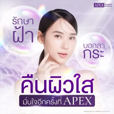 5 วิธีรักษาฝ้า กระ อยากรักษาให้หายขาด แก้ไขถึงต้นตอ