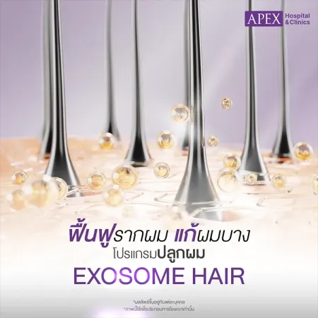 ปลูกผม Exosome Hair คืออะไร ฟื้นฟูรากผม แก้ปัญหาผมร่วงผมบาง