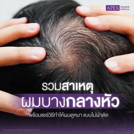 ผมบางกลางหัว เกิดจากสาเหตุอะไร มีสัญญาณเตือนอย่างไร