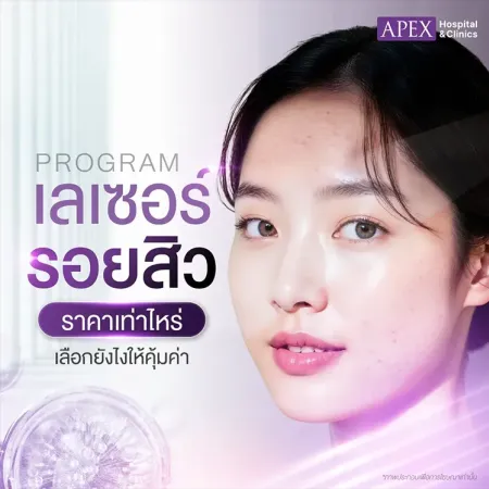เลเซอร์รอยสิว ราคาเท่าไหร่ กี่ครั้งเห็นผล อันตรายไหม 2025