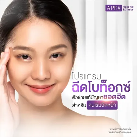 ฉีดโบท็อกซ์ คืออะไร ราคาเท่าไหร่ ฉีดบริเวณตรงไหนได้บ้าง
