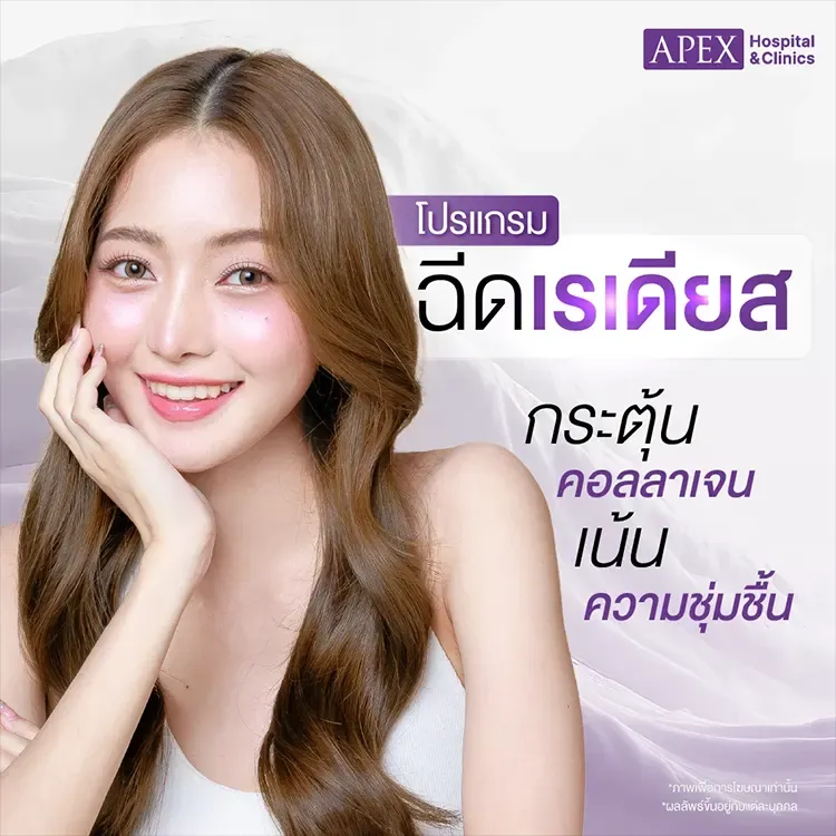 ฉีดเรเดียส (Radiesse) คืออะไร ต่างกับฟิลเลอร์ไหม ?