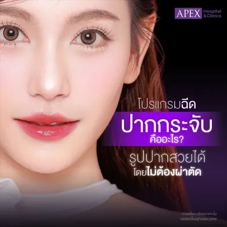 ฉีดปากกระจับ คืออะไร ฉีดปากอันตรายไหม มีข้อดีข้อเสียอย่างไร