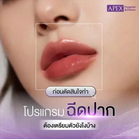 ฉีดปาก คืออะไร ฉีดครั้งแรกควรเตรียมตัวอย่างไร วิธีดูแลหลังฉีด