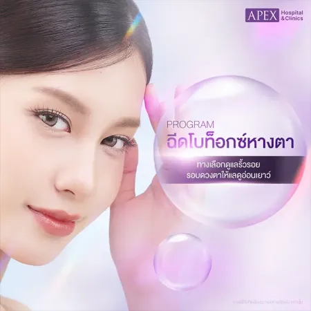 ฉีดโบท็อกซ์หางตา คืออะไร กี่วันเห็นผล ราคาเท่าไหร่