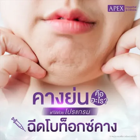 ฉีดโบท็อกซ์คาง คืออะไร แก้ปัญหาคางย่นคางผิวเปลือกได้ไหม