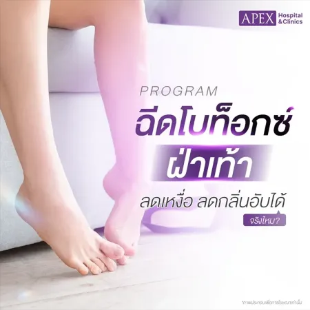 ฉีดโบท็อกซ์ฝ่าเท้า คืออะไร ช่วยลดเหงื่อที่ฝ่าเท้าได้อย่างไร