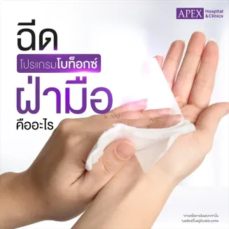 ฉีดโบท็อกซ์ฝ่ามือ คืออะไร ช่วยลดเหงื่อที่ฝ่ามือได้อย่างไร
