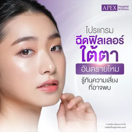 ฉีดฟิลเลอร์ใต้ตาอันตรายไหม ฉีดใต้ตาเกิดการบวมช้ำดูแลอย่างไร