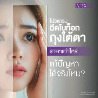 ฉีดโบท็อกถุงใต้ตาราคาเท่าไหร่ เหมาะกับใคร กี่วันเห็นผล