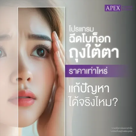 ฉีดโบท็อกถุงใต้ตาราคาเท่าไหร่ เหมาะกับใคร กี่วันเห็นผล