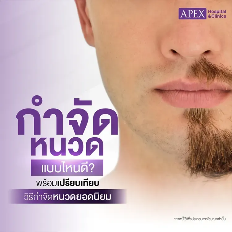 5 วิธีกำจัดหนวด ทำกี่ครั้งเห็นผล เลือกแบบไหนดี แตกต่างกันไหม