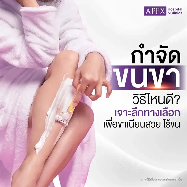 กำจัดขนขา มีกี่วิธีอะไรบ้าง ข้อดีข้อเสียแตกต่างกันอย่างไร