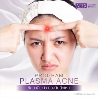 Plasma Acne คืออะไร แก้ปัญหาสิว 3 ขั้นตอน กี่วันเห็นผล ดีไหม