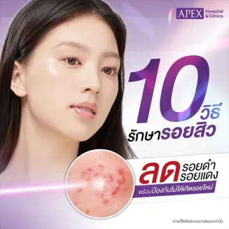 รอยสิว คืออะไร สาเหตุเกิดจาก 10 วิธีรักษาป้องกันไม่ให้เกิดรอยใหม่