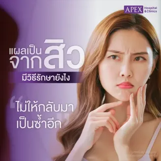 แผลเป็นจากสิว สาเหตุเกิดจากอะไร วิธีรักษาและป้องกันอย่างไร