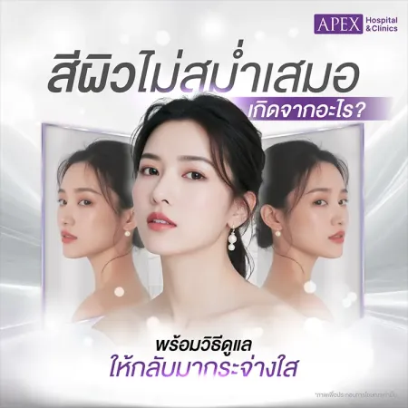 สีผิวไม่สม่ำเสมอ สาเหตุเกิดจากอะไร แก้ยังไง ผิวดูกระจ่างใส