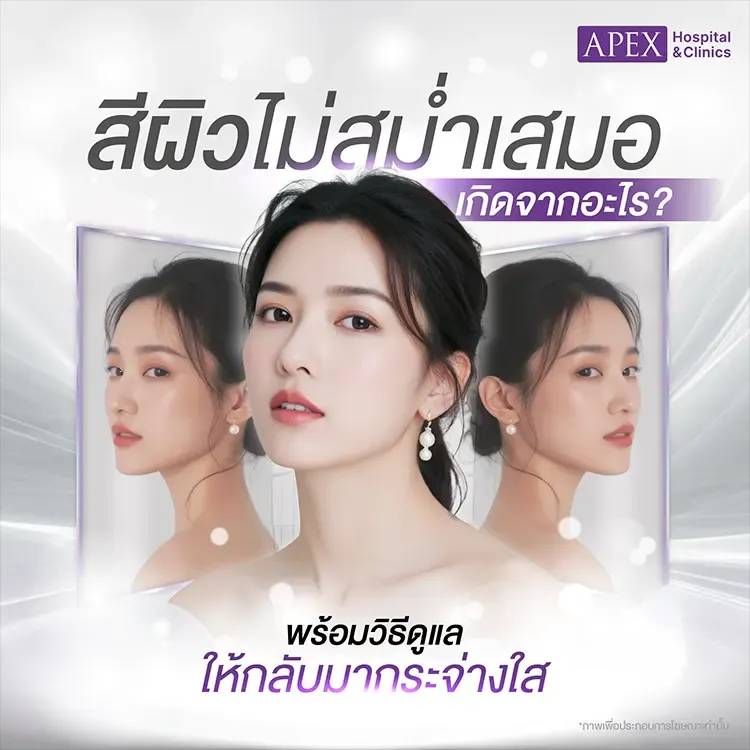 สีผิวไม่สม่ำเสมอ สาเหตุเกิดจากอะไร แก้ยังไง ผิวดูกระจ่างใส