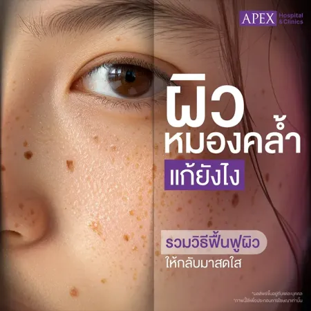 ผิวหมองคล้ำ เกิดจากสาเหตุอะไร วิธีแก้ไขปัญหาหน้าโทรมอย่างไร