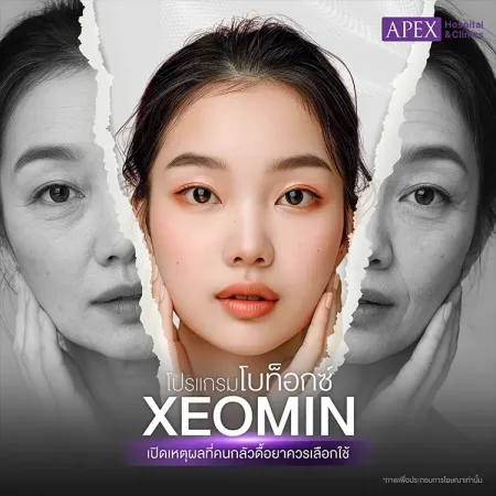 โบท็อกซ์ Xeomin คืออะไร แตกต่างจากฉีดโบอื่นอย่างไร