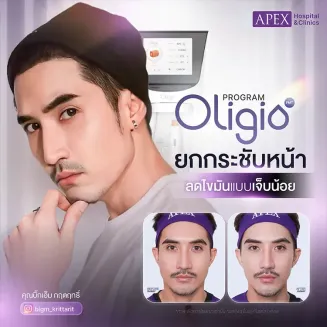Oligio ยกกระชับลดความหย่อนคล้อย (คุณบิ๊กเอ็ม กฤตฤทธิ์ บุตรพรม)