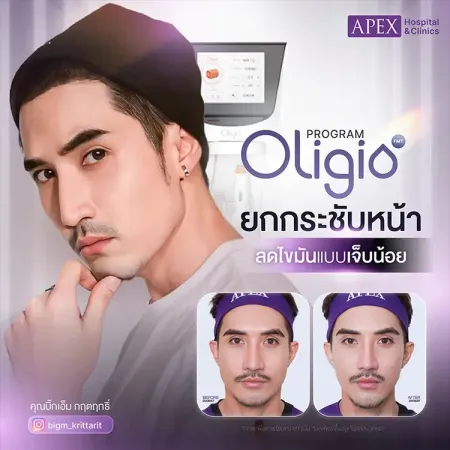 Oligio ยกกระชับลดความหย่อนคล้อย (คุณบิ๊กเอ็ม กฤตฤทธิ์ บุตรพรม)
